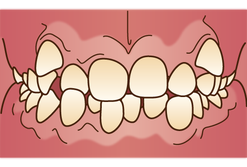 orthodontics033
