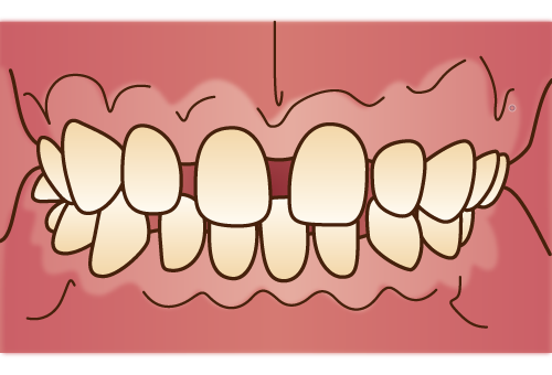 orthodontics034