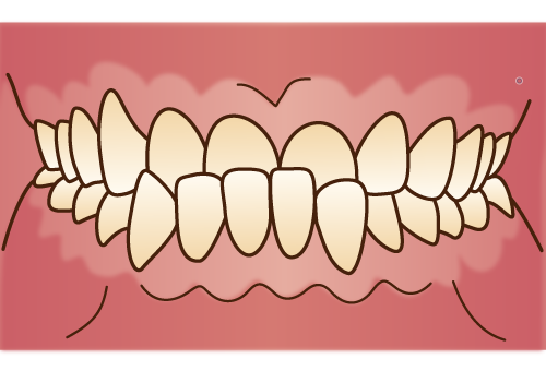 orthodontics035