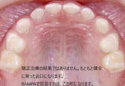 お口3.2