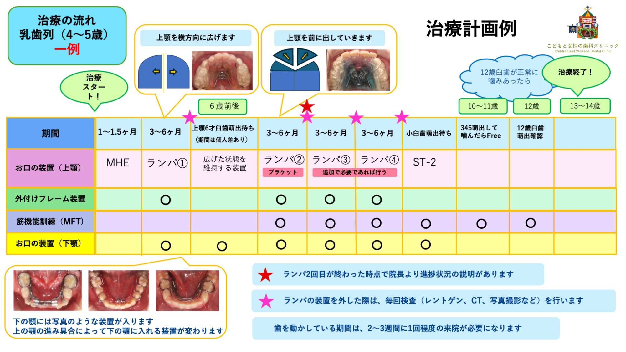 ランパセラピー治療計画例
