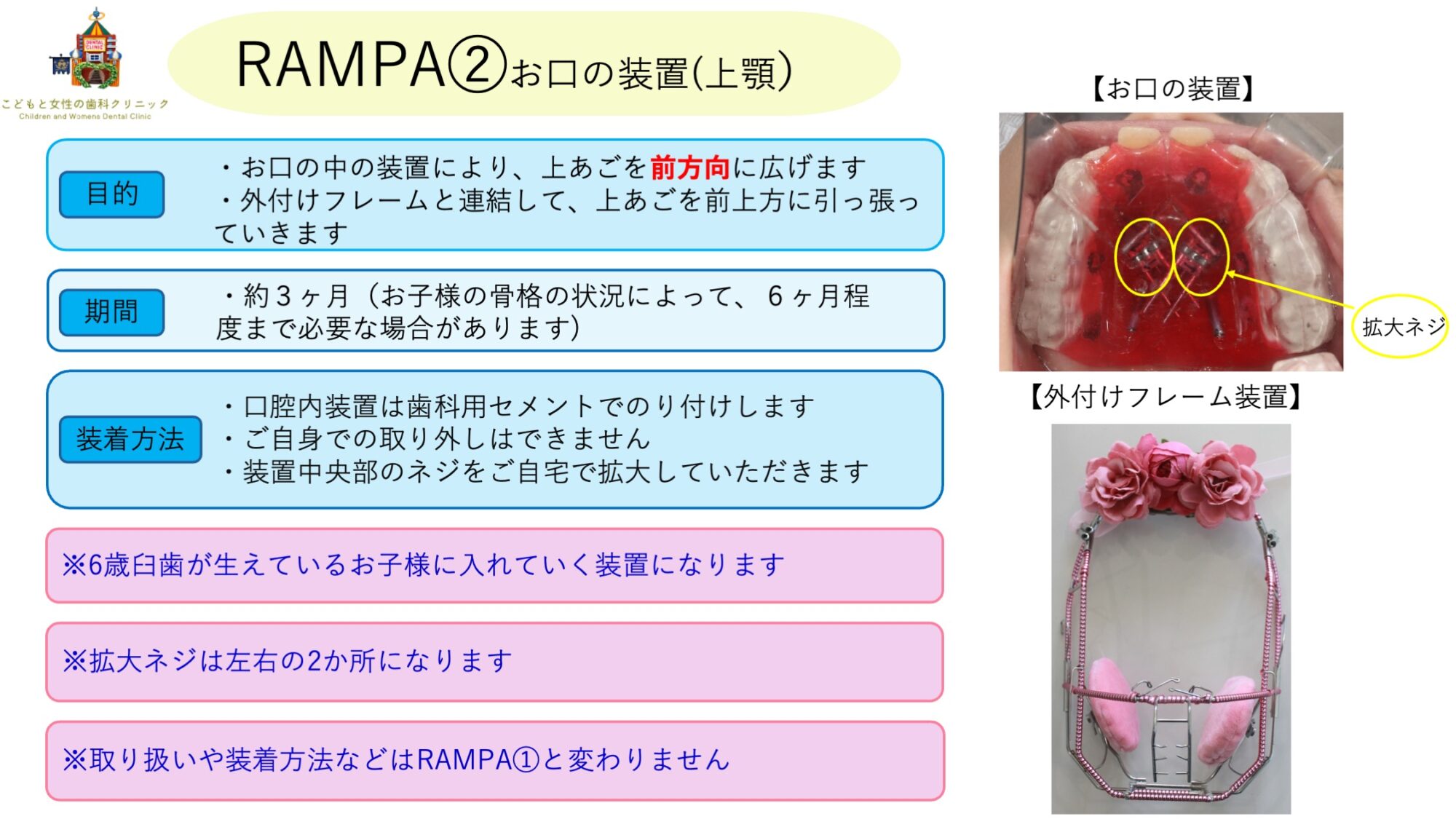 RAMPAの装置