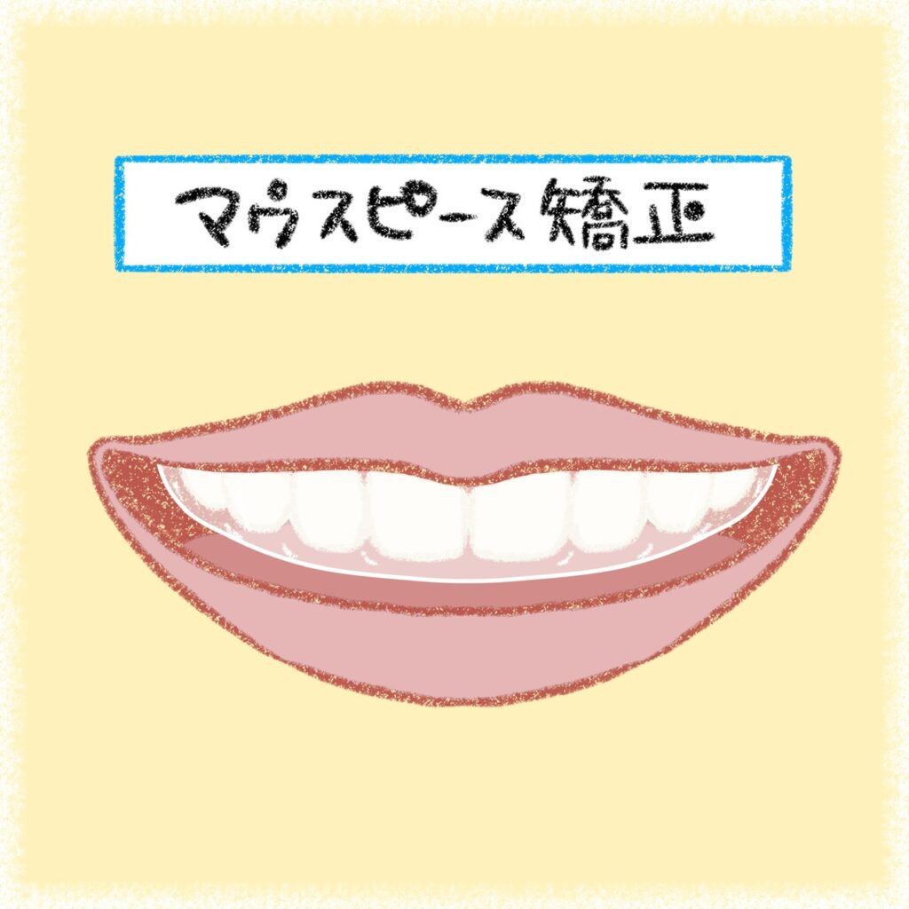 マウスピース矯正