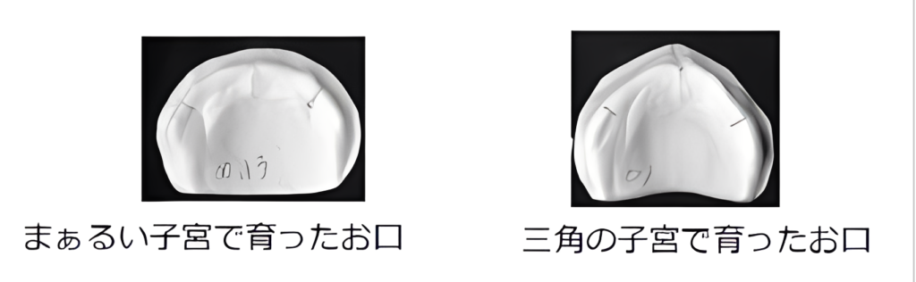 まるい顎とさんかくの顎の型