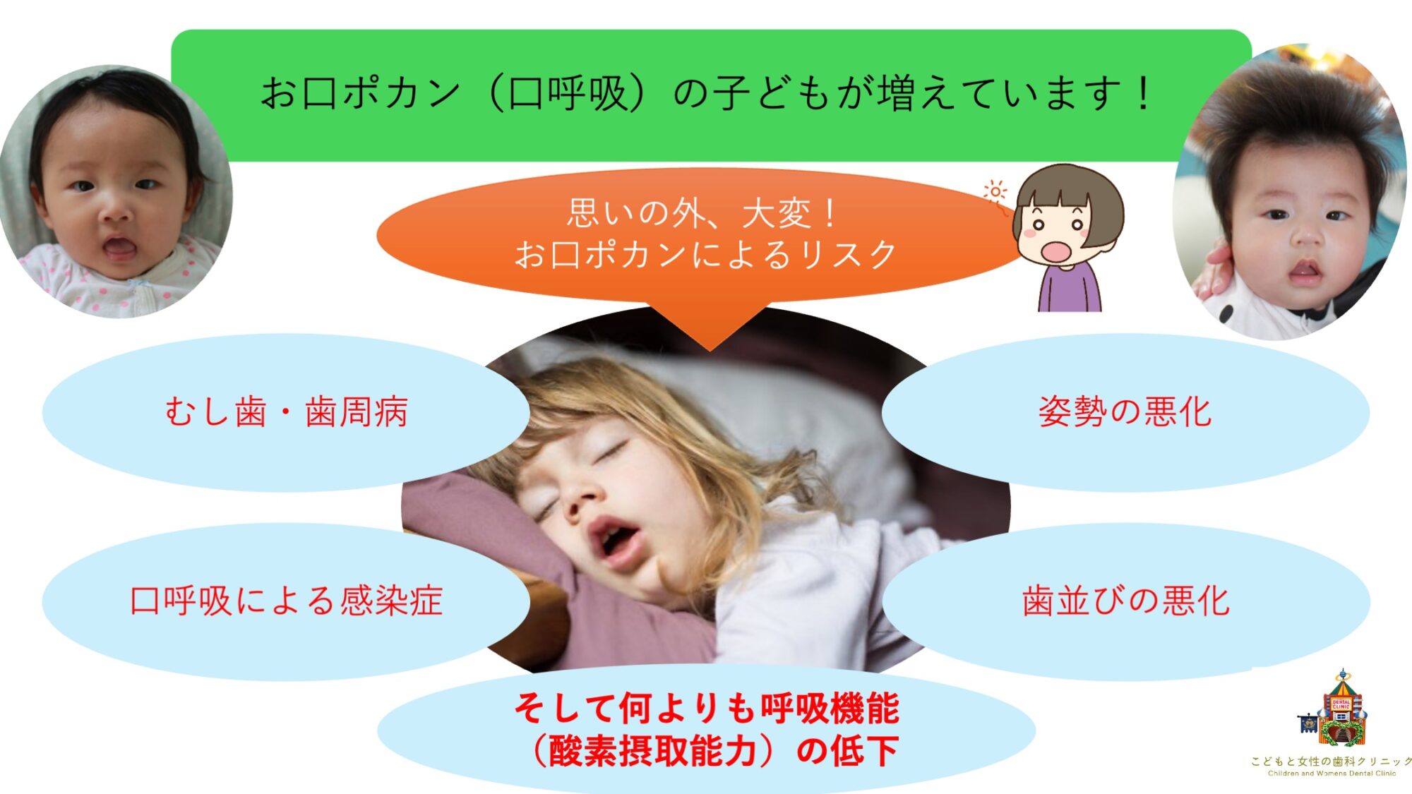 こどもと女性の歯科クリニック お口ポカン(口呼吸)によって起こる諸症状リスト