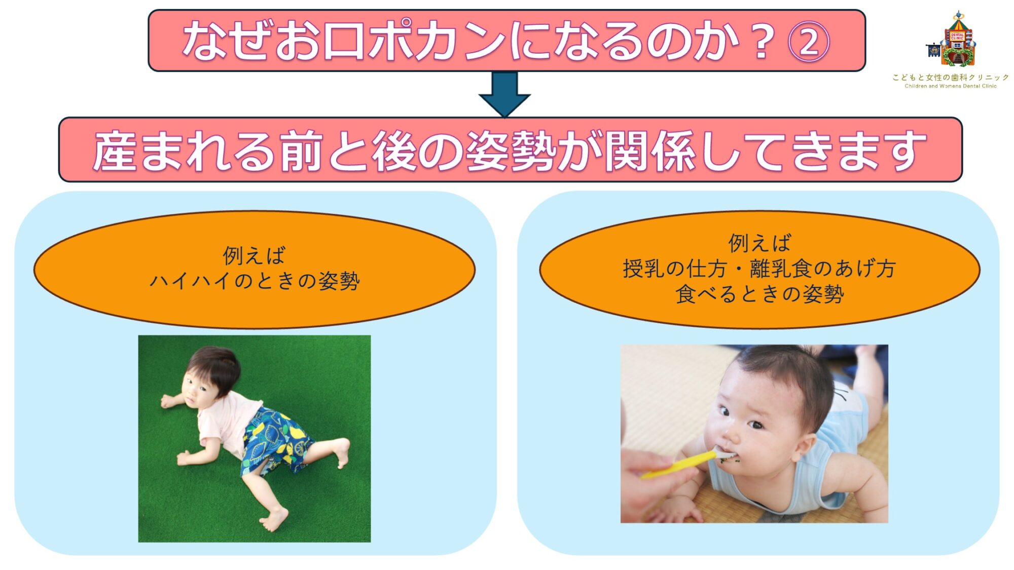 なぜお口ポカンリスト２