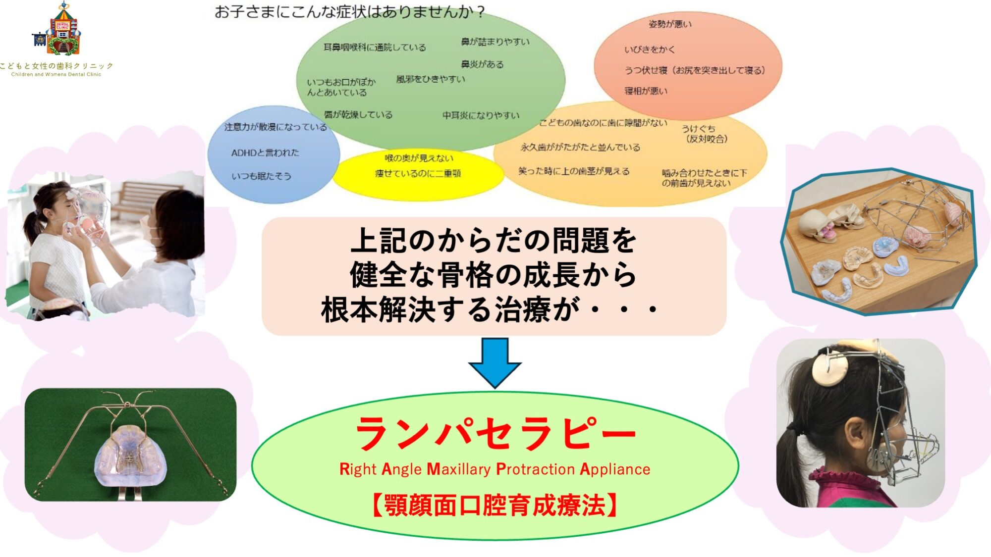 ランパセラピー概要イラスト