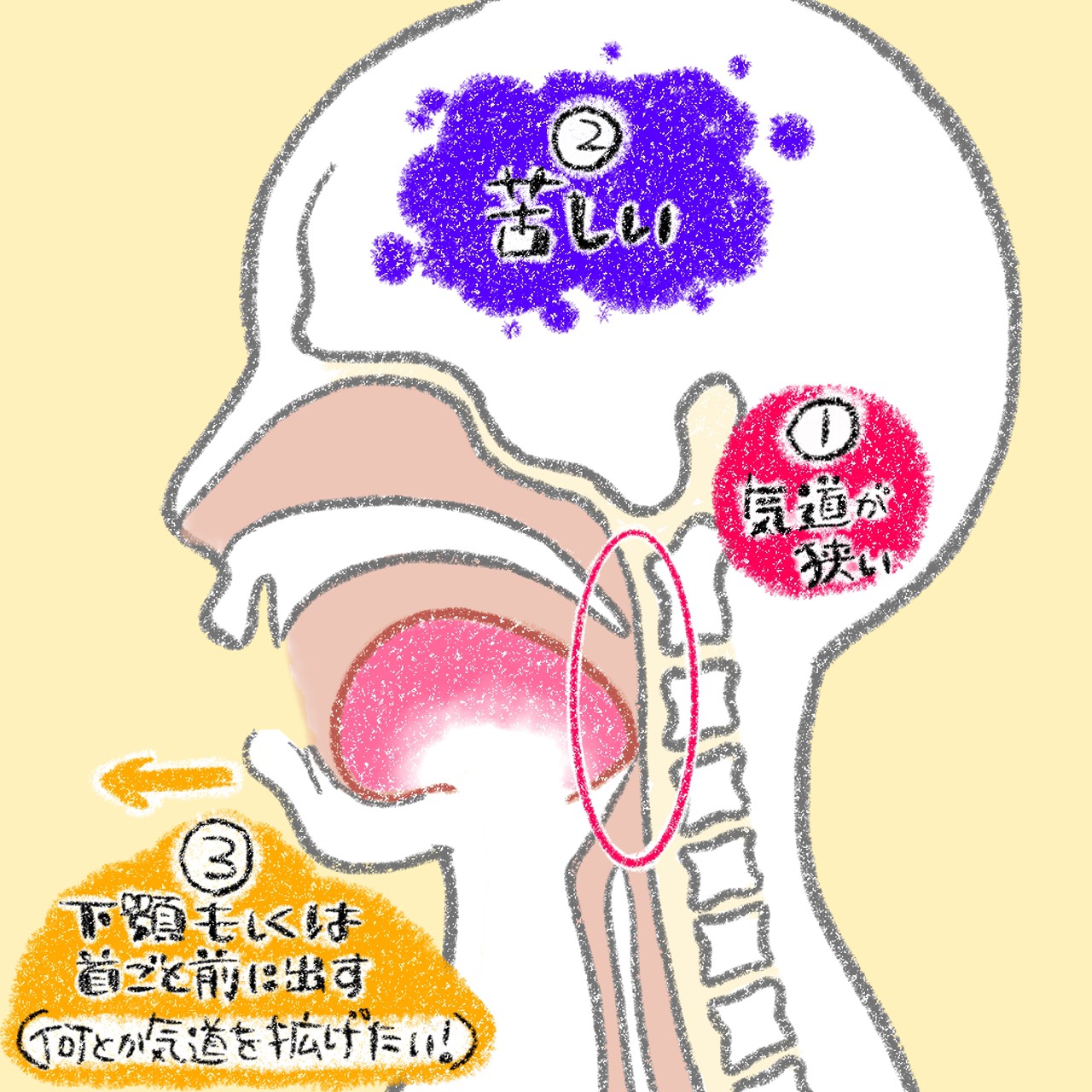 口呼吸が気道狭くさせ、姿勢の悪さや受け口に繋がる