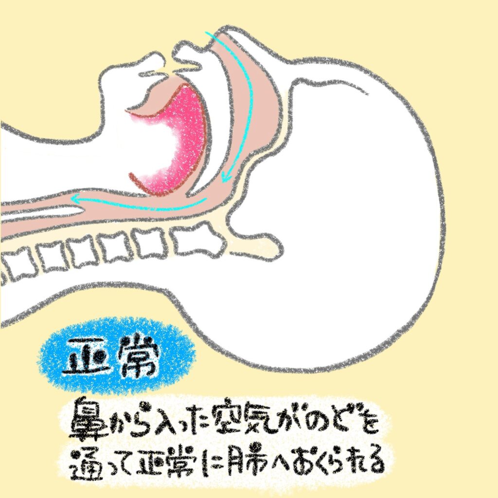 こどもと女性の歯科クリニック 睡眠時の正常な空気の流れ