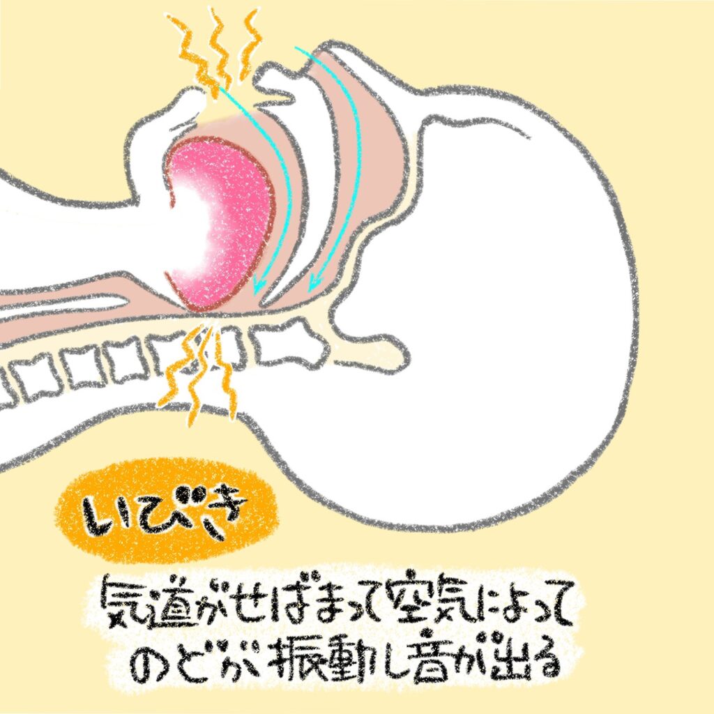 こどもと女性の歯科クリニック いびきをかいている時の空気の流れ