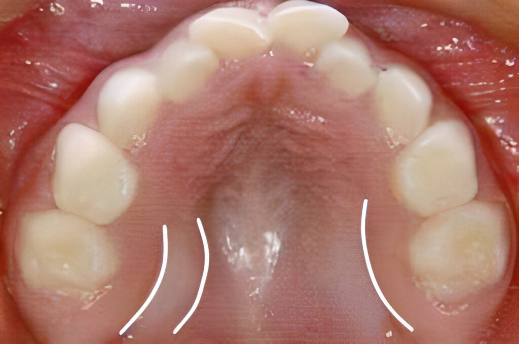 ※画像の鮮明化のためにAIを使用しています。