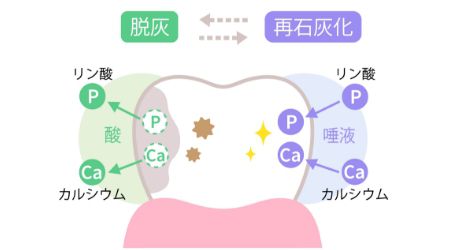 脱灰と再石灰化の仕組みを示したイラスト