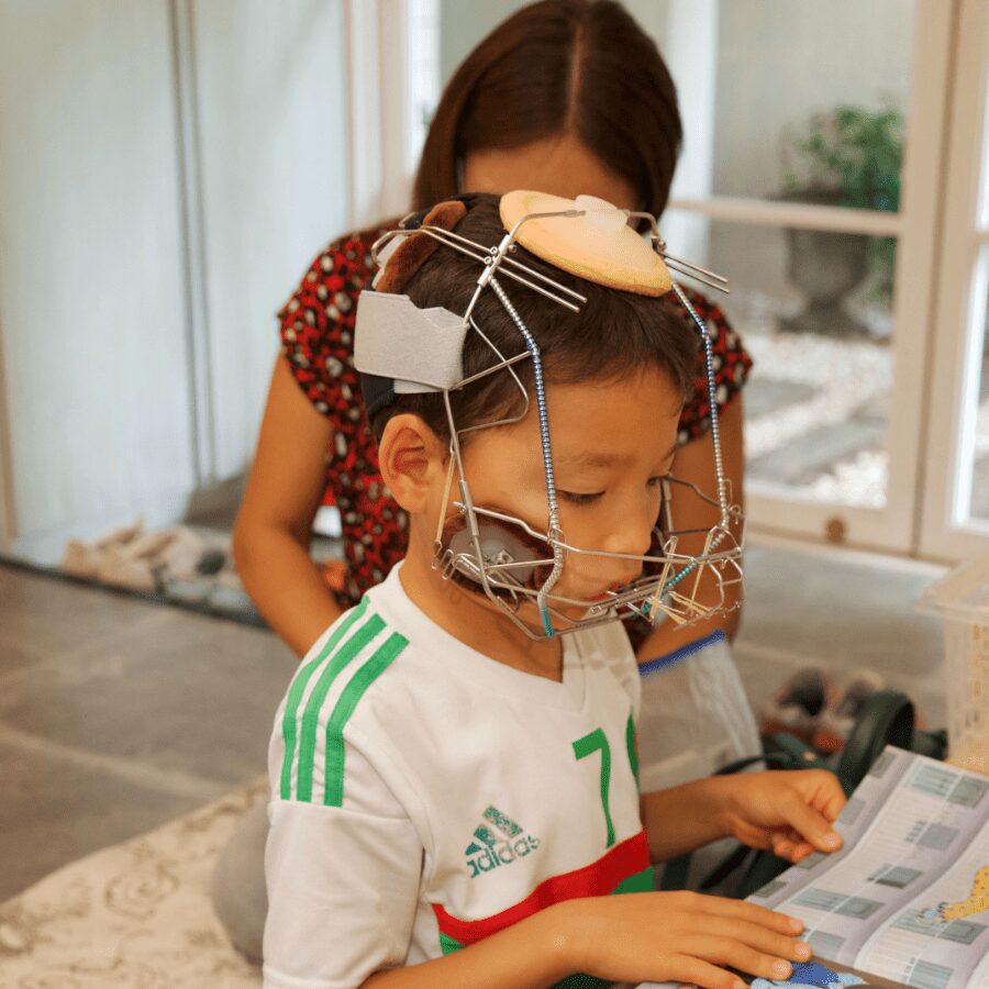 矯正器具を装着している子ども