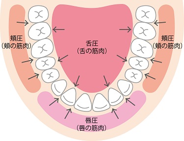 ri6