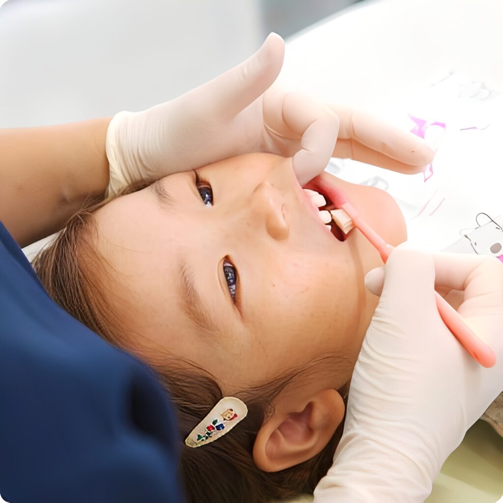 歯磨きをしてもらっている子ども