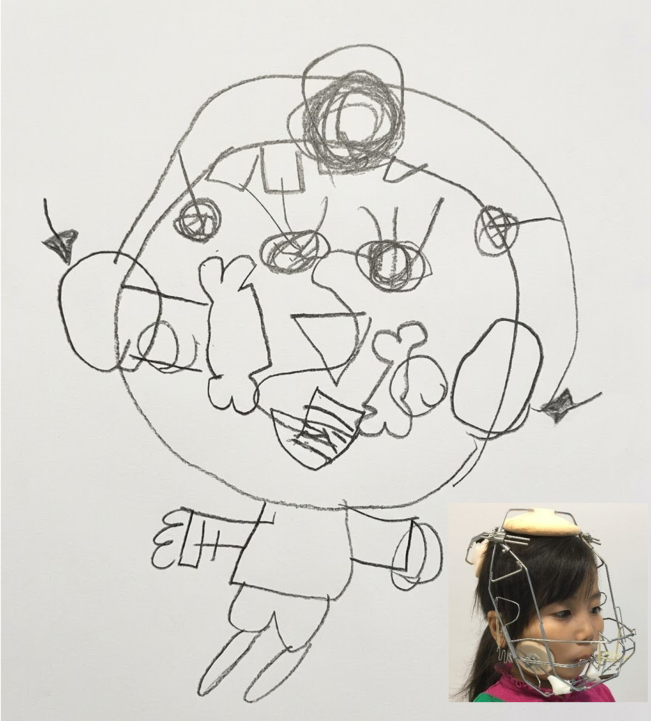 RAMPAの装置と子どもが描いてくれたイラスト