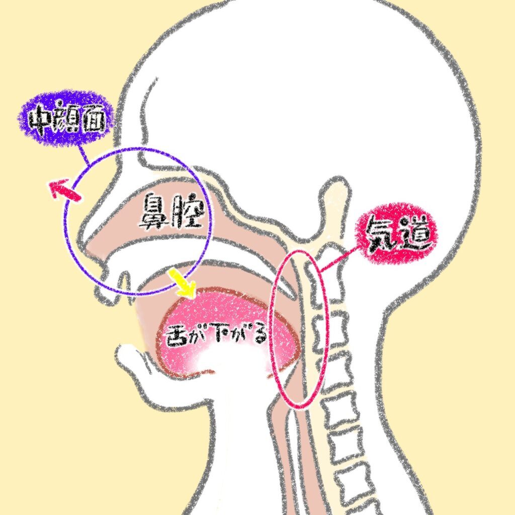 口呼吸は鼻腔や気道を狭くさせる