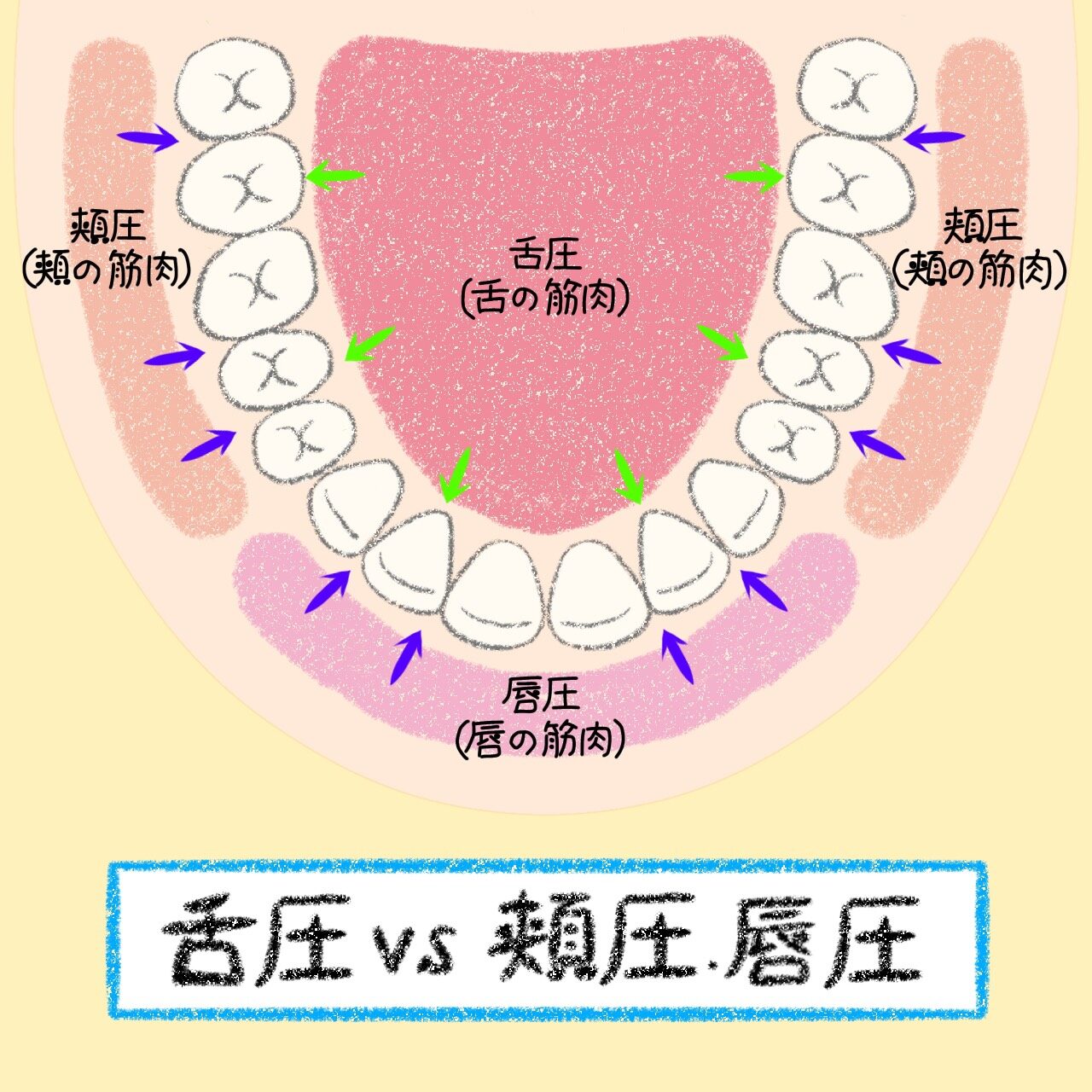 舌圧と頬圧・唇圧の関係を示すイラスト