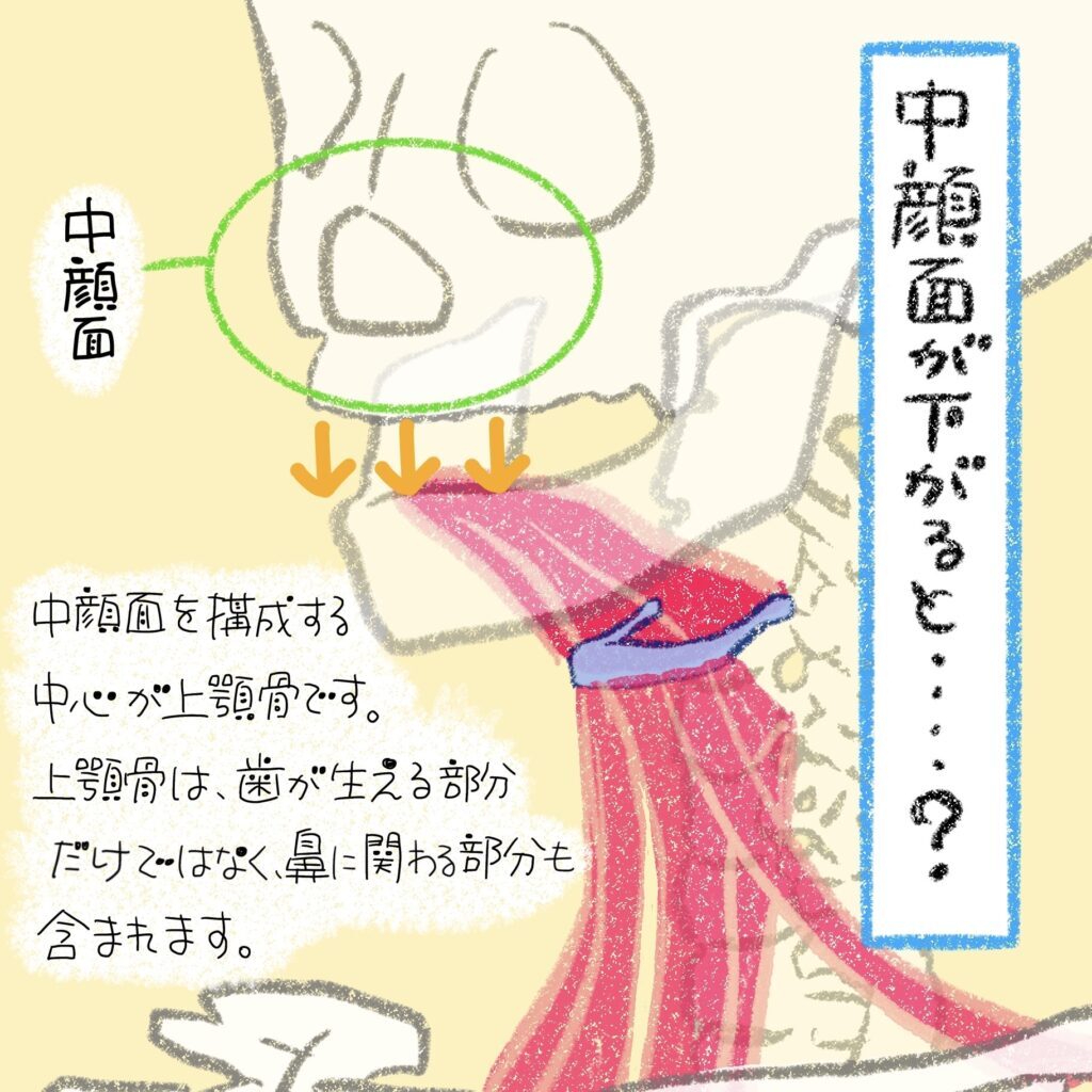 中顔面を構成する上顎骨は歯と鼻に関わる骨と示すイラスト
