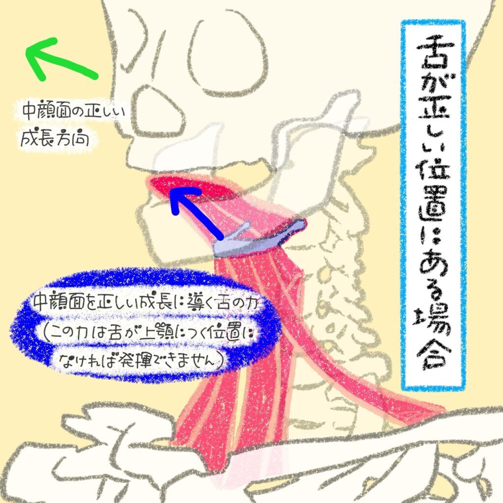 舌の正しい働き（鼻呼吸）によって中顔面が正しく成長するメカニズムを示すイラスト